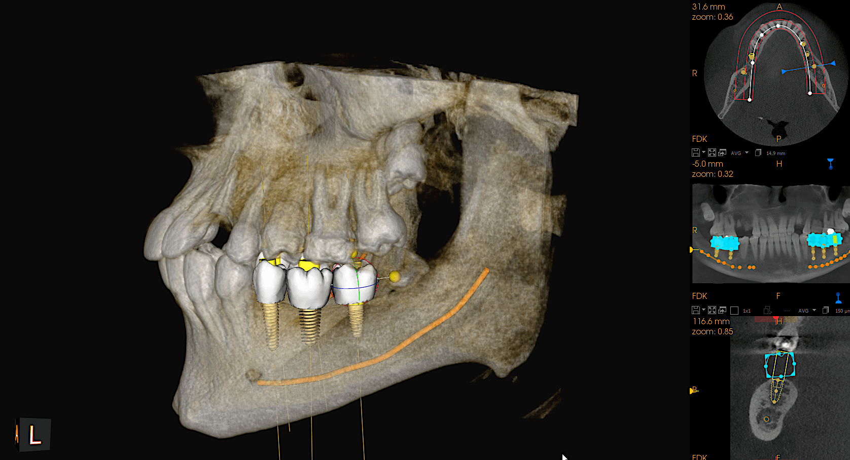 tomografia szczęki w Białymstoku